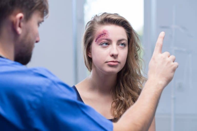 How to Check for Concussion Eyes