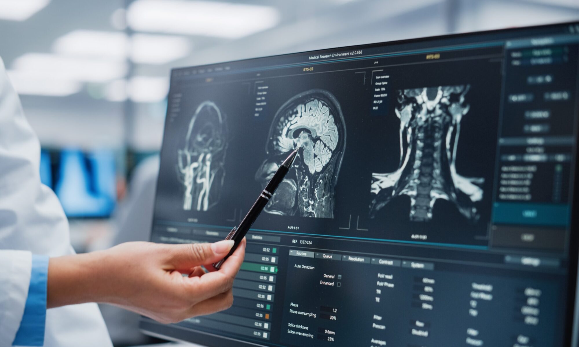 average settlement for traumatic brain injury