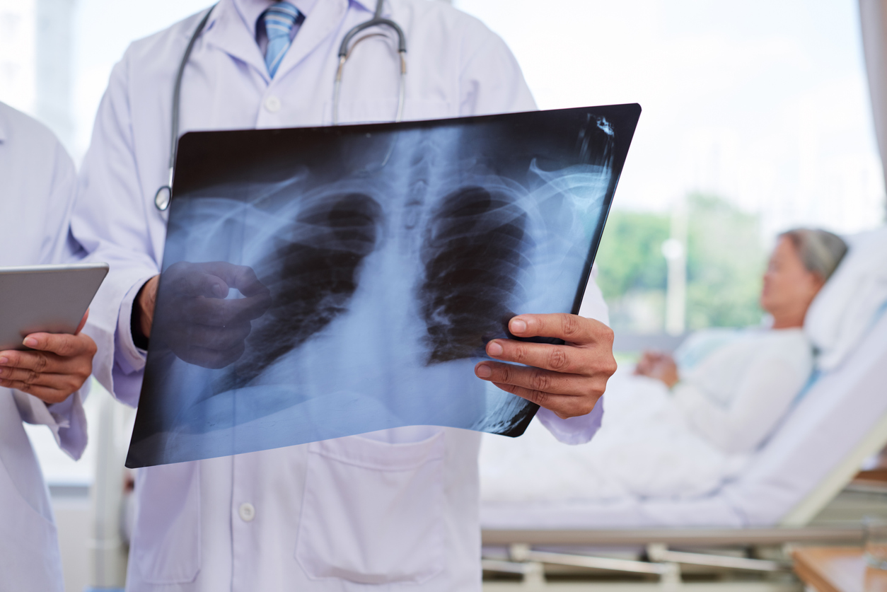 sternum pain after car accident4