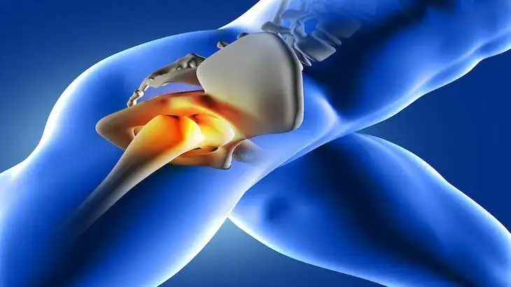hip pain after car accident 2