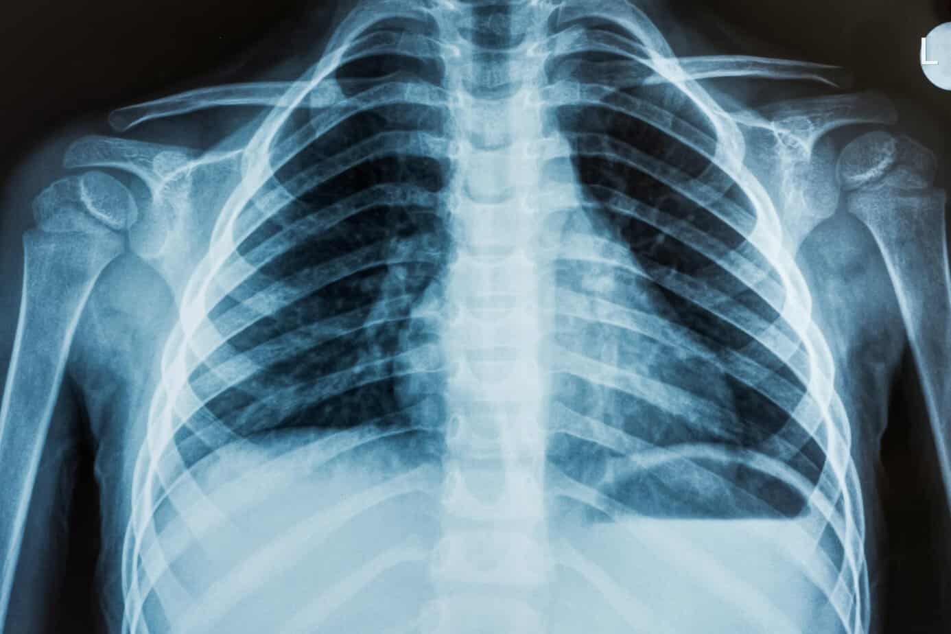 x ray bear de